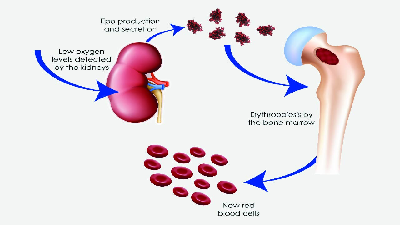 Anemia Management in Kidney Disease